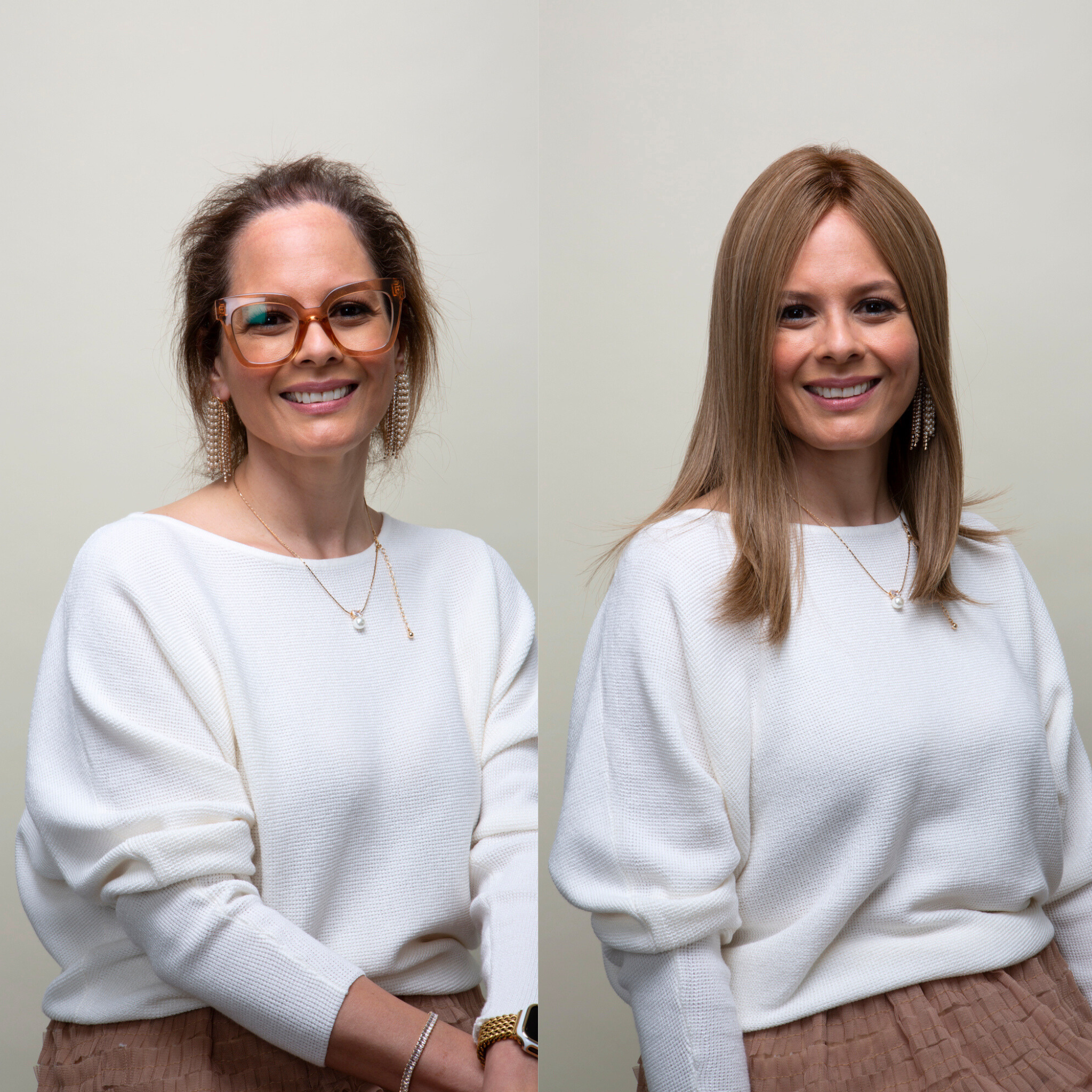 Hair topper before and after image of a woman; left shows thinning hair, right shows fuller hair with a hair topper.