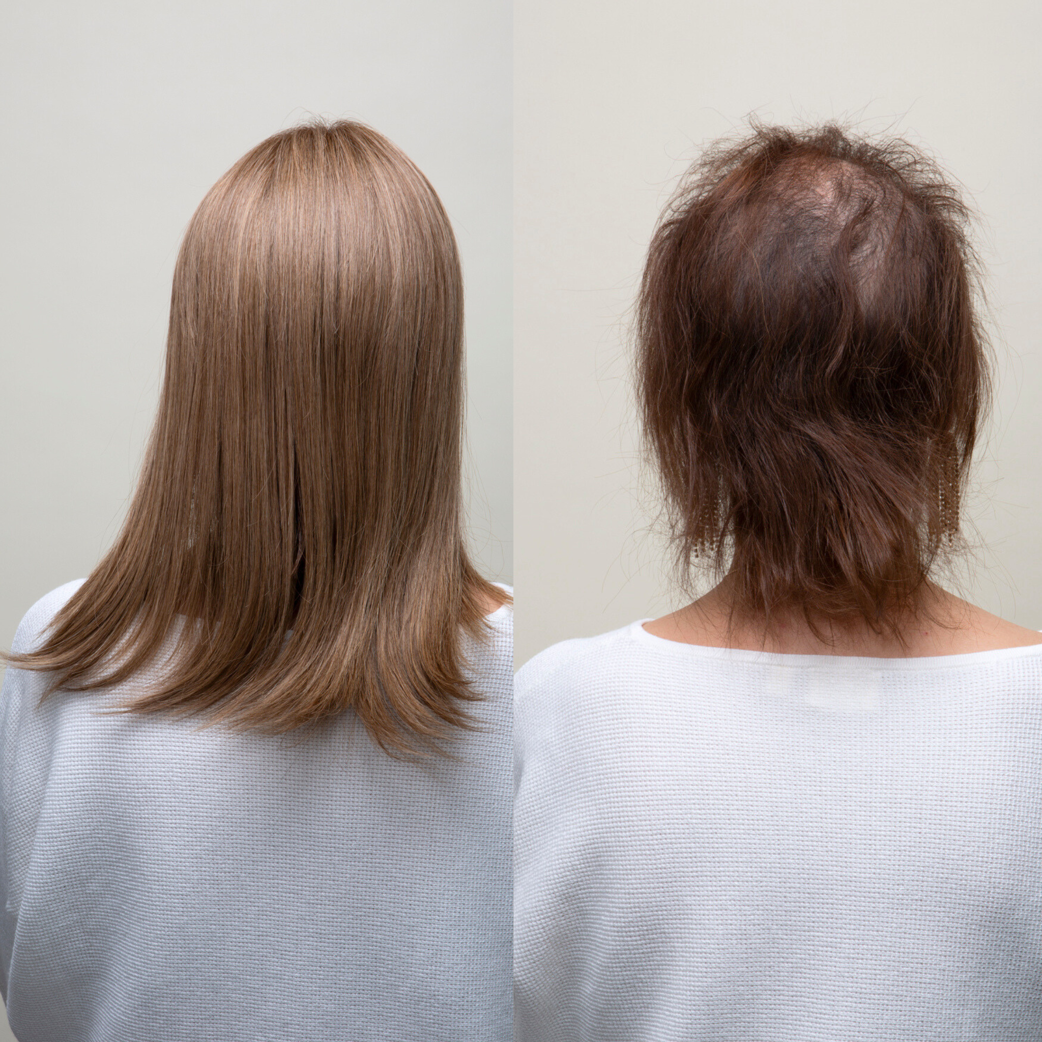 Back view hair topper before and after image of a woman; left shows thinning hair, right shows fuller hair with a hair topper.