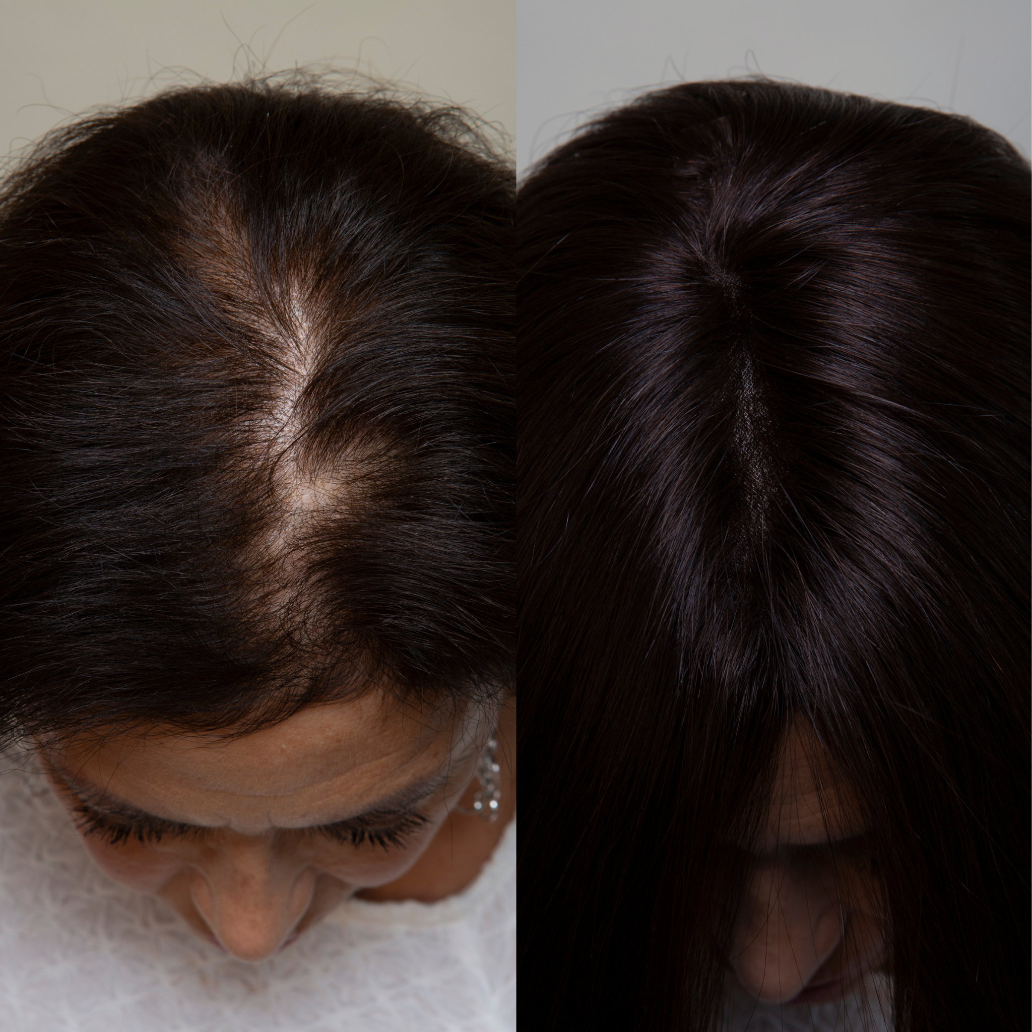 Clio 12 S PLUS | Remy Human Hair Topper (Reinforced Hand-Tied Base)