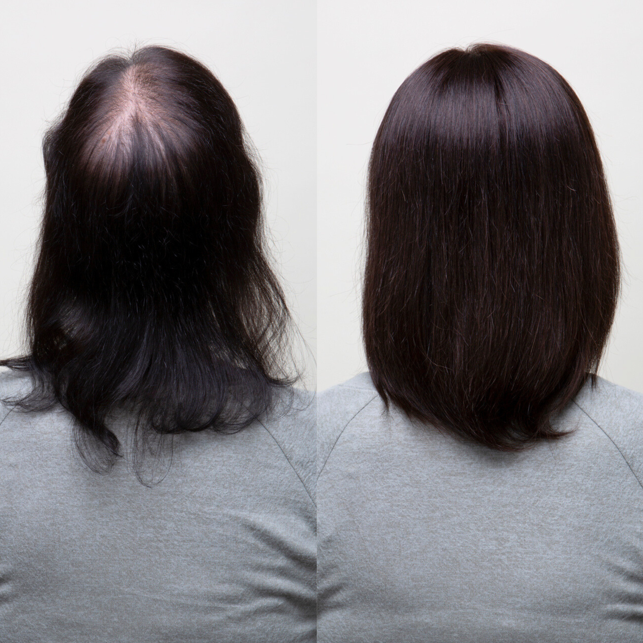 Clio 12 L | Remy Human Hair Topper (Hand-Made)