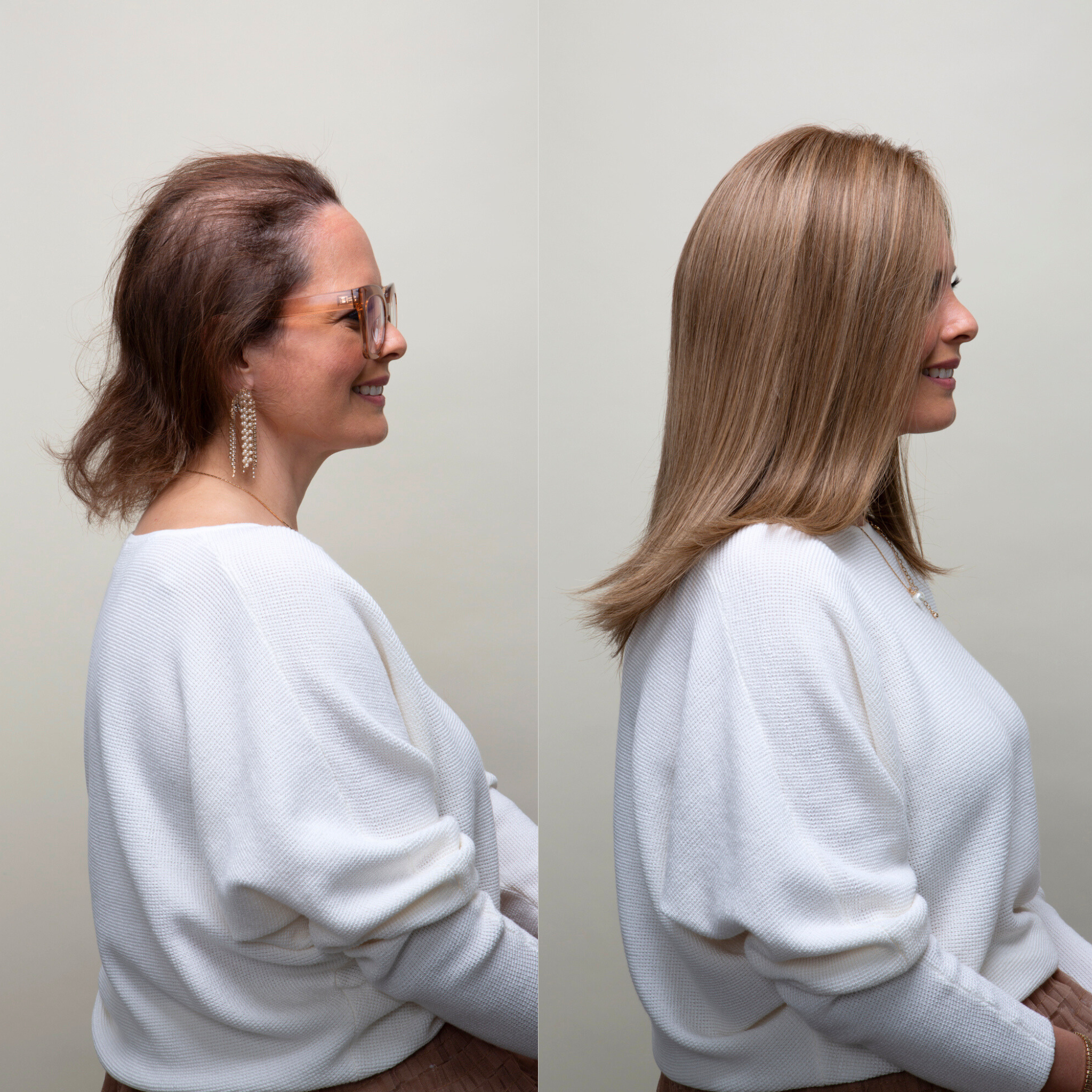 Side view hair topper before and after image of a woman; left shows thinning hair, right shows fuller hair with a hair topper.