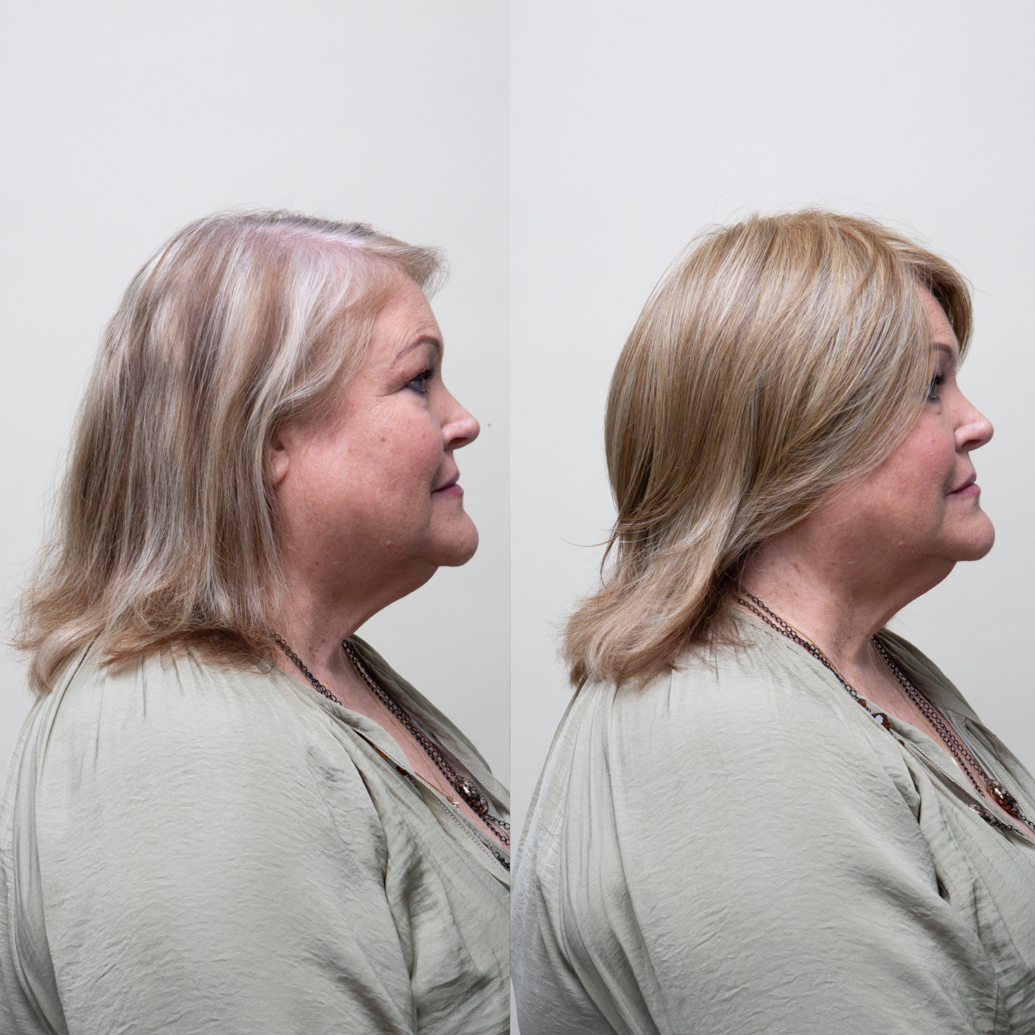 Image shows a woman before and after using a synthetic hair topper; left shows natural hair, right displays enhanced volume.